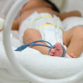 Bayi lahir prematur dirawat dalam incubator