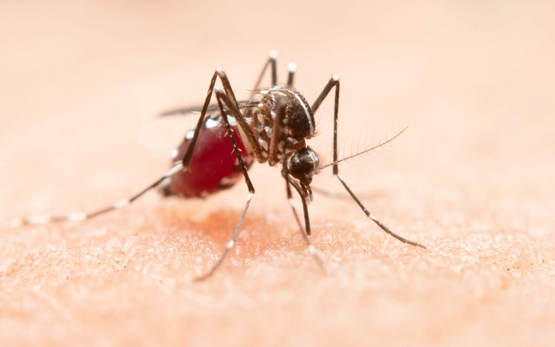 Dengue Fever: Causes, Symptoms, and Prevention